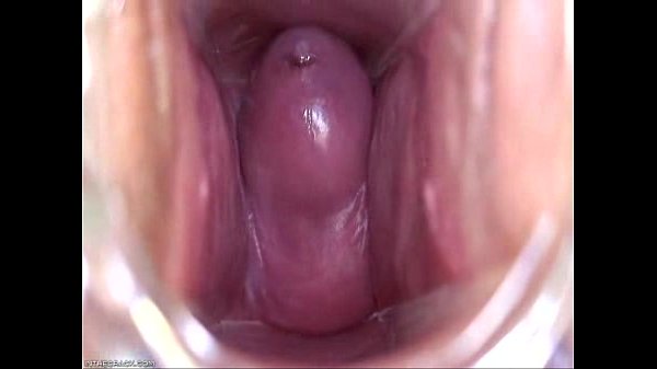 amateur,inside,speculum